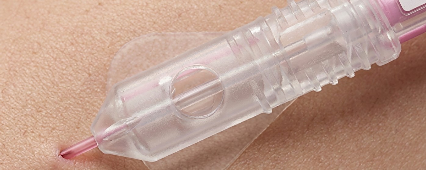 Passive Needle Retraction